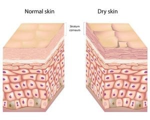 Dry Skin | Which Dry Skin Cream? | Manchester | Clear Medical Clinic